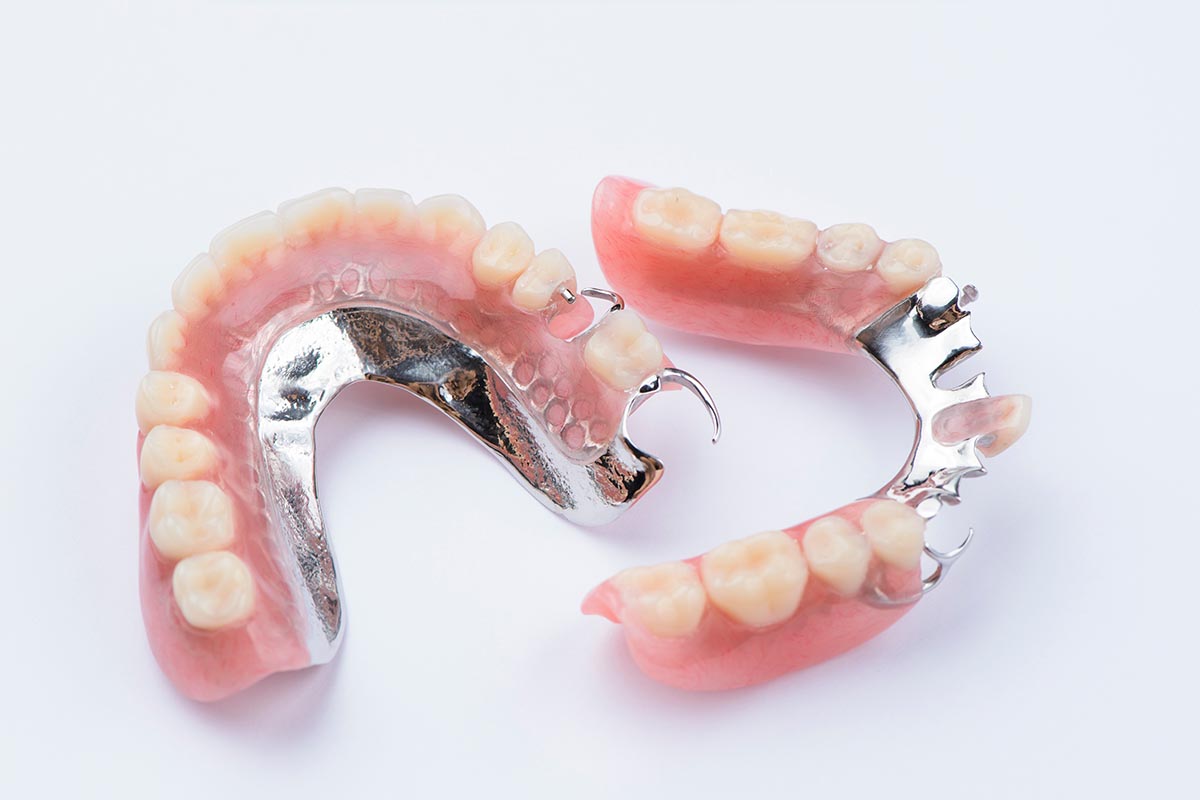 Partial Dentures